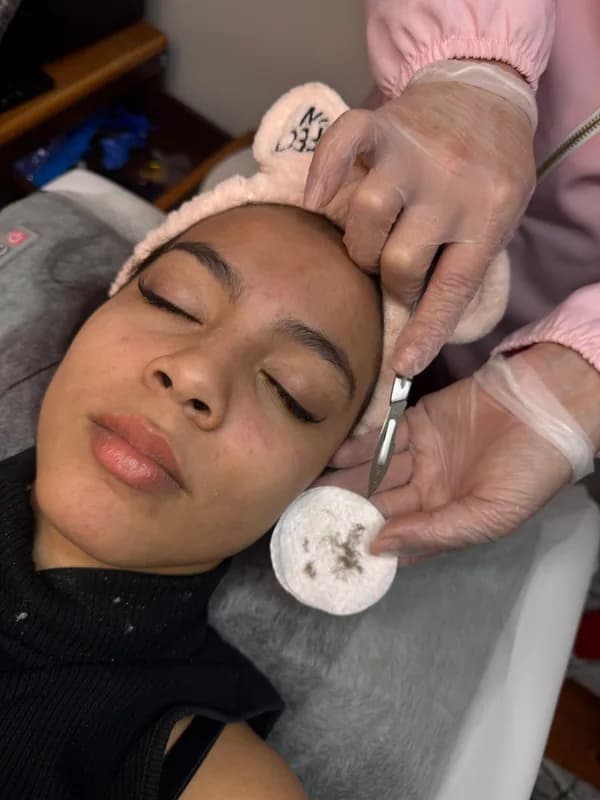 Dermaplaning em Coimbra — Alessandra Gomes Estética