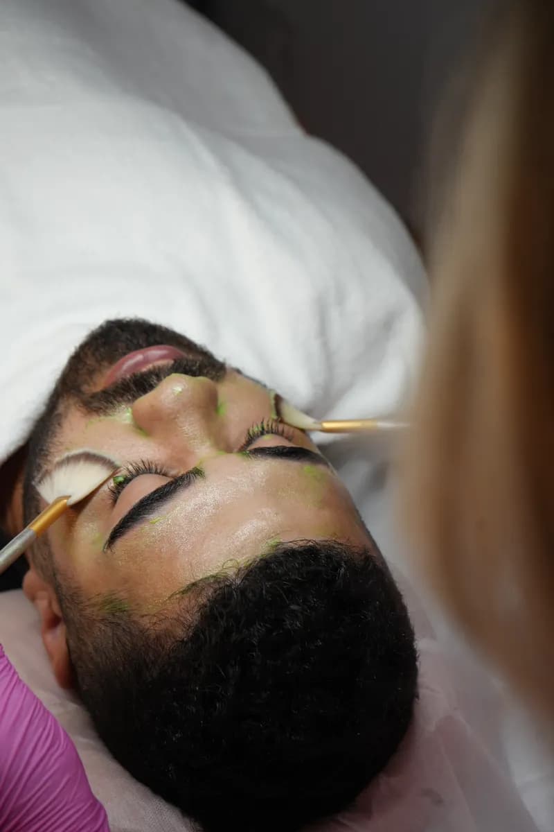 Tratamento Melasma em Coimbra — Alessandra Gomes Estética